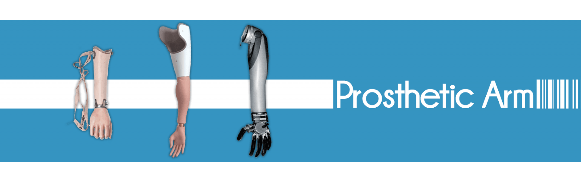 Prosthetic Arm